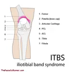 What is IT Band Syndrome (ITBS) and how do we prevent it?